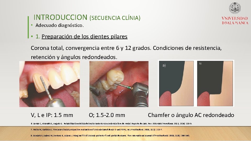 INTRODUCCION (SECUENCIA CLÍNIA) • Adecuado diagnóstico. • 1. Preparación de los dientes pilares Corona