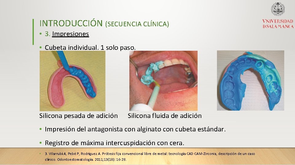 INTRODUCCIÓN (SECUENCIA CLÍNICA) • 3. Impresiones • Cubeta individual. 1 solo paso. Silicona pesada