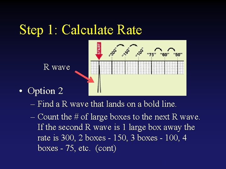 Step 1: Calculate R wave • Option 2 – Find a R wave that