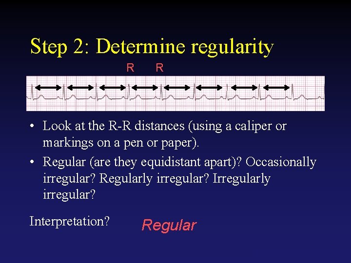 Step 2: Determine regularity R R • Look at the R-R distances (using a