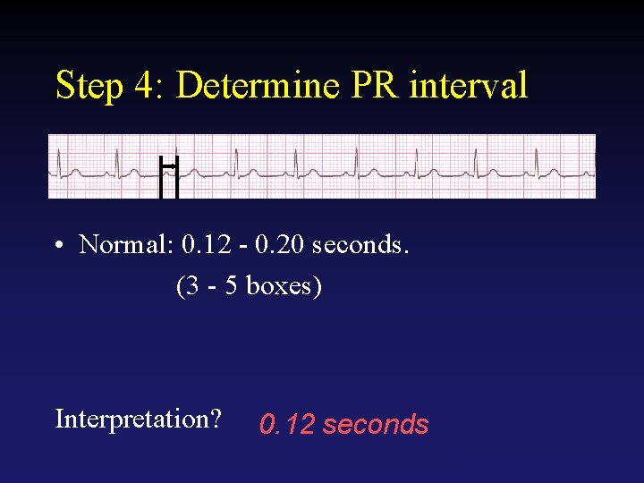 Step 4: Determine PR interval • Normal: 0. 12 - 0. 20 seconds. (3