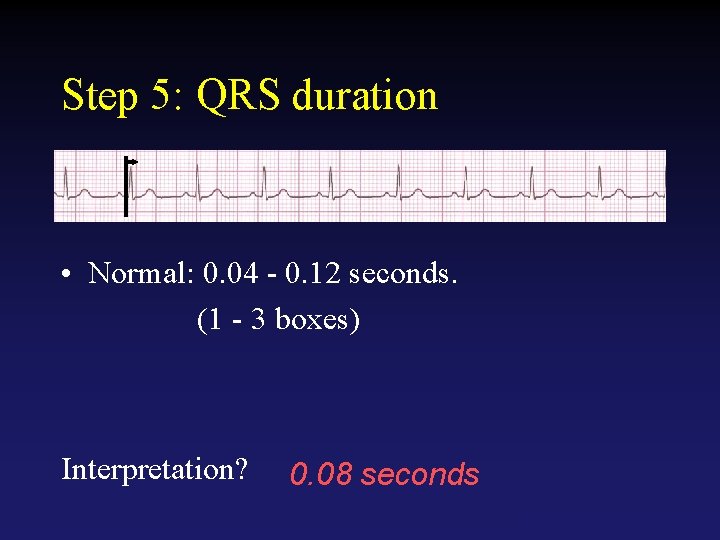 Step 5: QRS duration • Normal: 0. 04 - 0. 12 seconds. (1 -