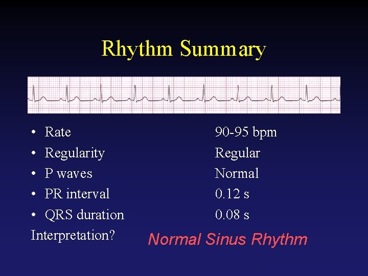 Rhythm Summary • Rate • Regularity • P waves • PR interval • QRS