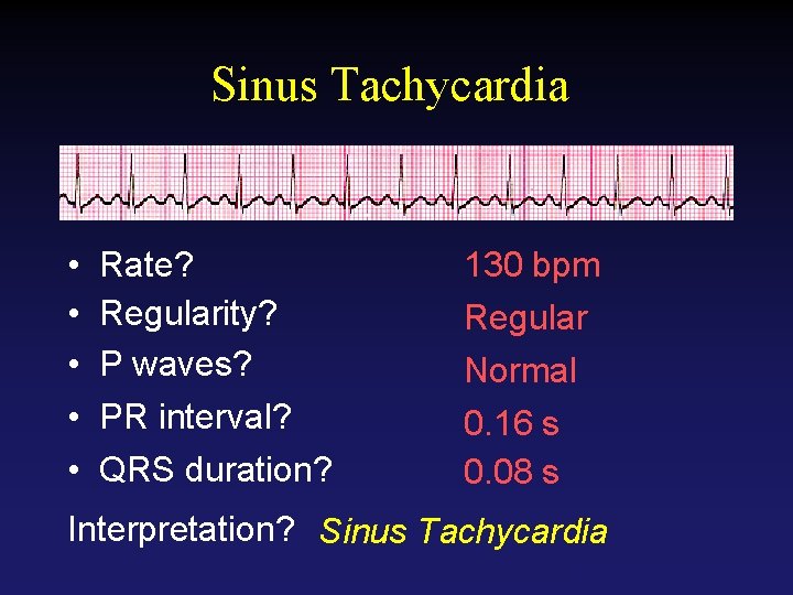 Sinus Tachycardia • • • Rate? Regularity? P waves? PR interval? QRS duration? 130