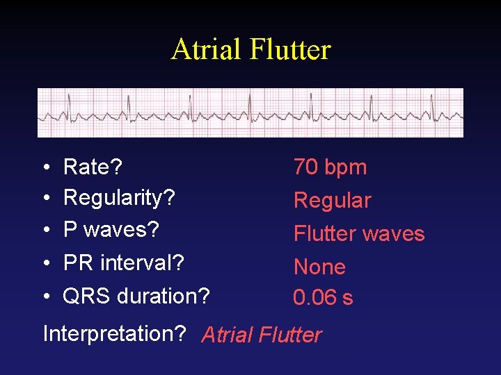 Atrial Flutter • • • Rate? Regularity? P waves? PR interval? QRS duration? 70