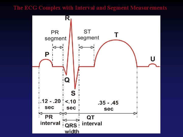 The ECG Complex with Interval and Segment Measurements 