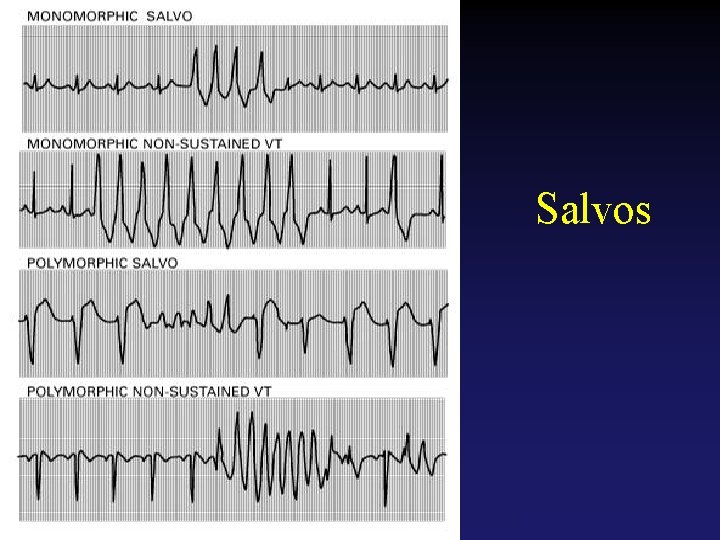 Salvos Tehran Arrhythmia Center 