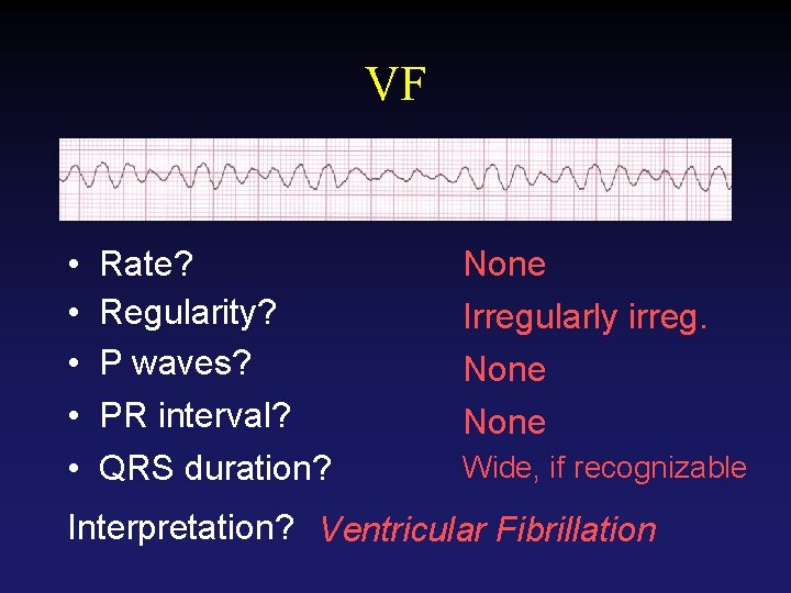VF • • • Rate? Regularity? P waves? PR interval? QRS duration? None Irregularly