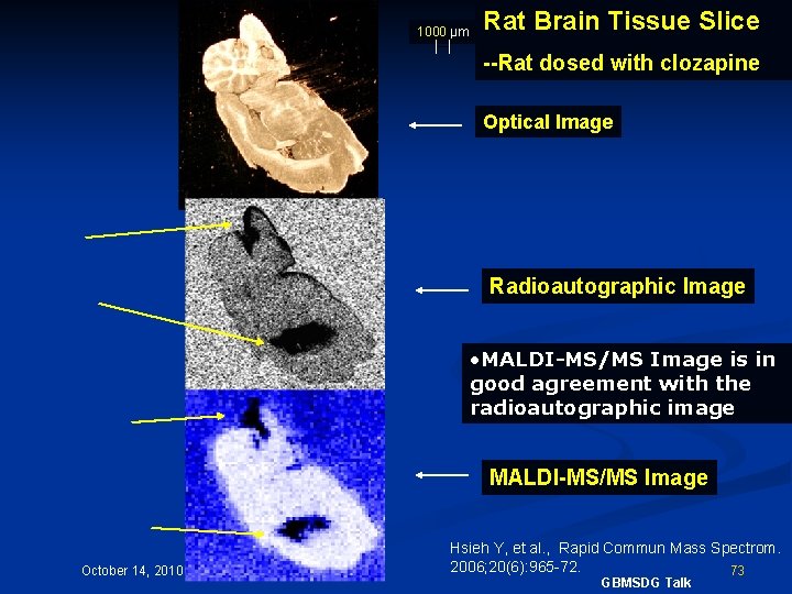 1000 µm Rat Brain Tissue Slice --Rat dosed with clozapine Optical Image Radioautographic Image