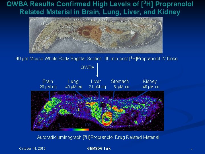 QWBA Results Confirmed High Levels of [3 H] Propranolol Related Material in Brain, Lung,