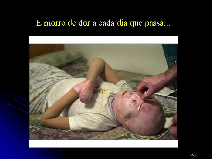 E morro de dor a cada dia que passa. . . >>> 