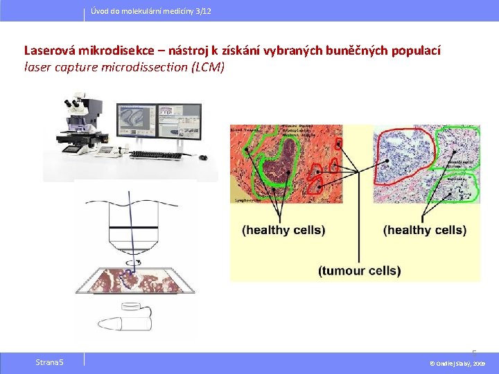 Úvod do molekulární medicíny 3/12 Laserová mikrodisekce – nástroj k získání vybraných buněčných populací