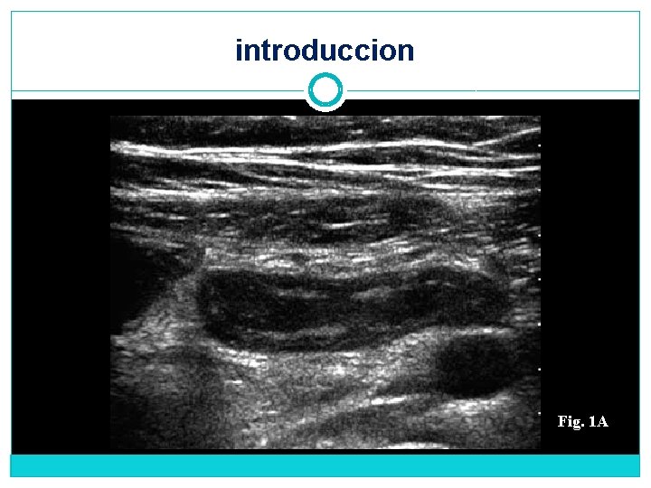 introduccion Fig. 1 A 