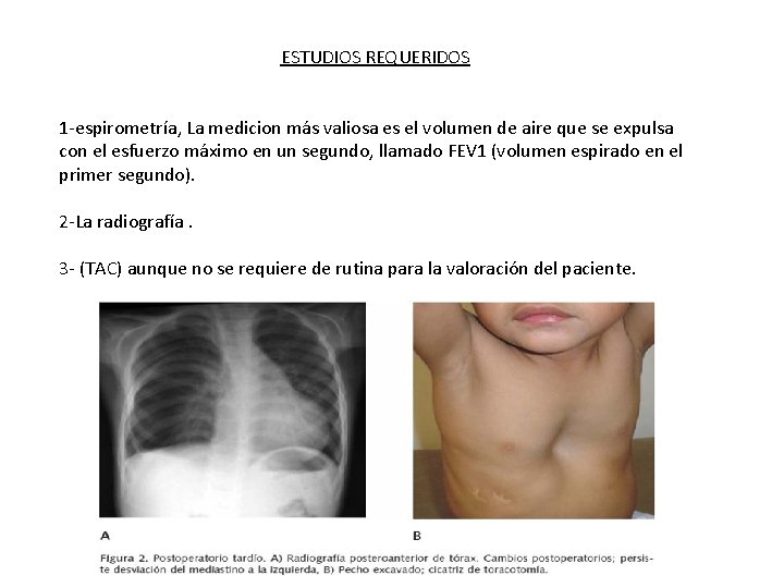ESTUDIOS REQUERIDOS 1 -espirometría, La medicion más valiosa es el volumen de aire que