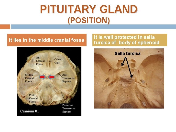 PITUITARY GLAND (POSITION) It lies in the middle cranial fossa It is well protected