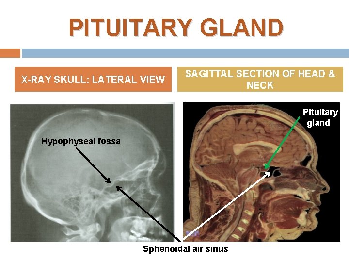 PITUITARY GLAND X-RAY SKULL: LATERAL VIEW SAGITTAL SECTION OF HEAD & NECK Pituitary gland