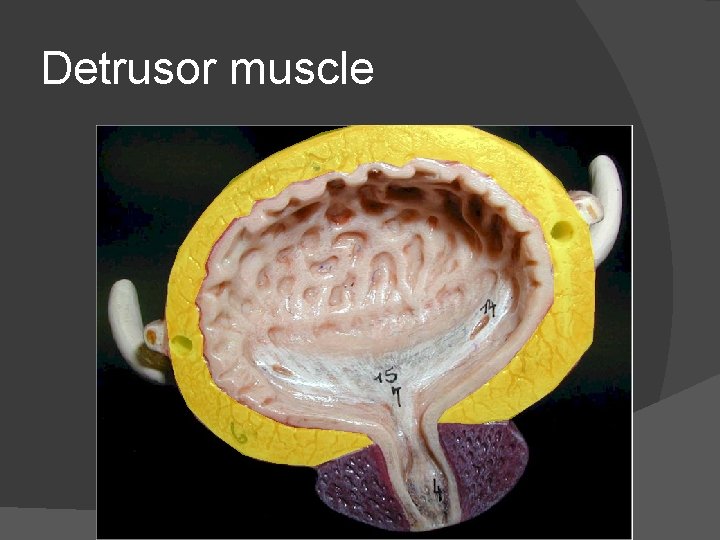 Detrusor muscle 