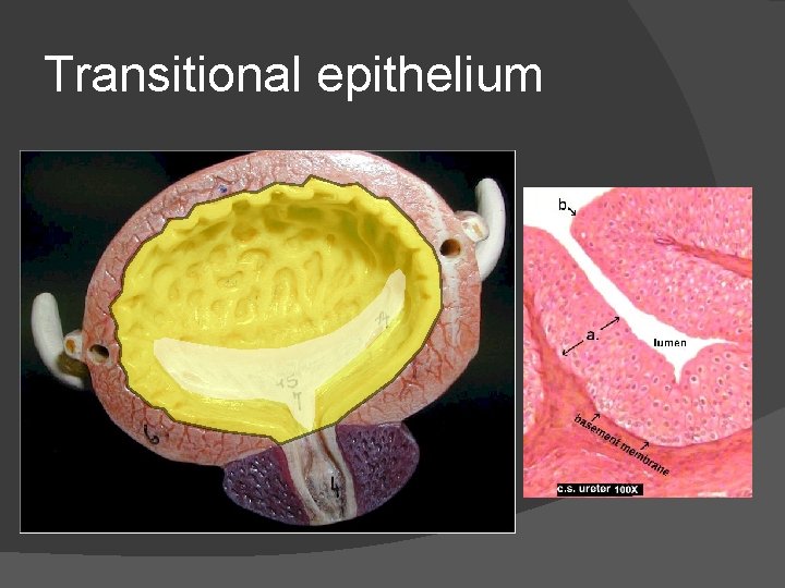 Transitional epithelium 
