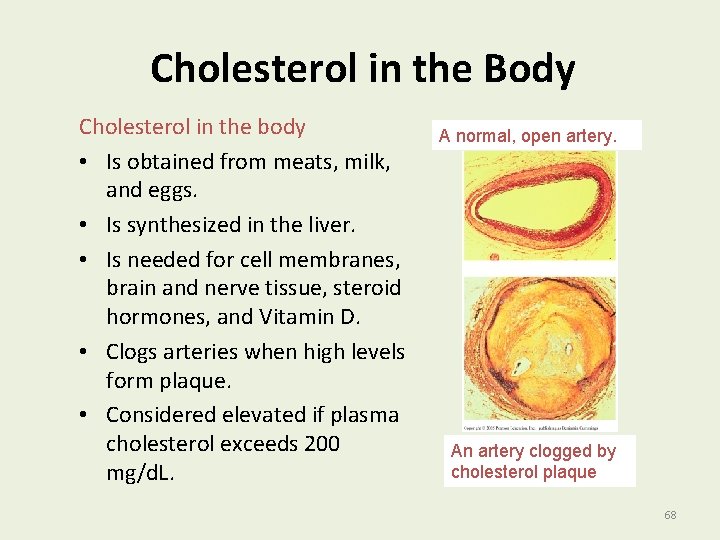 Cholesterol in the Body Cholesterol in the body • Is obtained from meats, milk,