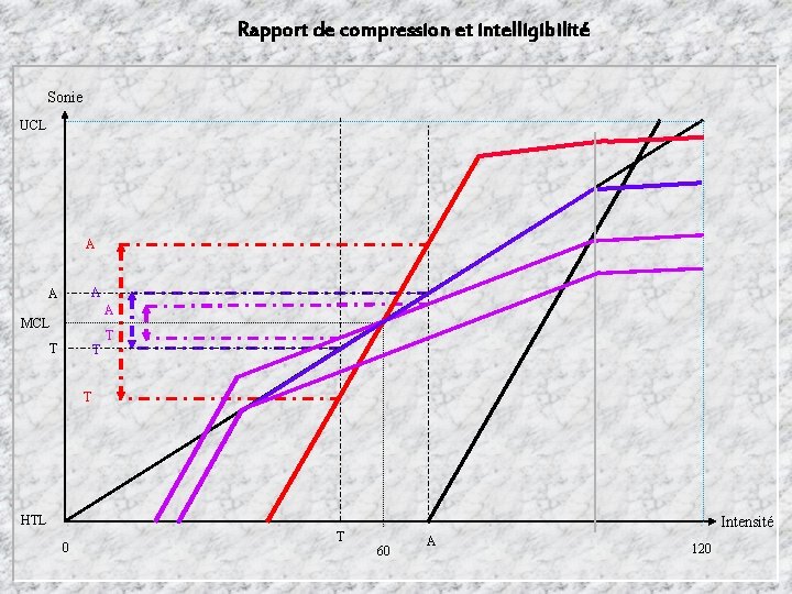 Rapport de compression et intelligibilité Sonie UCL A A MCL T T HTL 0