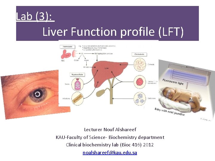 Lab (3): Liver Function profile (LFT) Lecturer Nouf Alshareef KAU-Faculty of Science- Biochemistry department