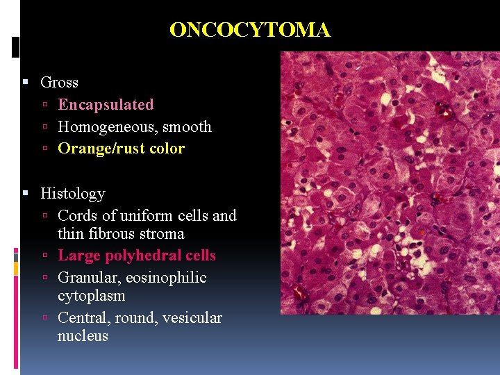 ONCOCYTOMA Gross Encapsulated Homogeneous, smooth Orange/rust color Histology Cords of uniform cells and thin