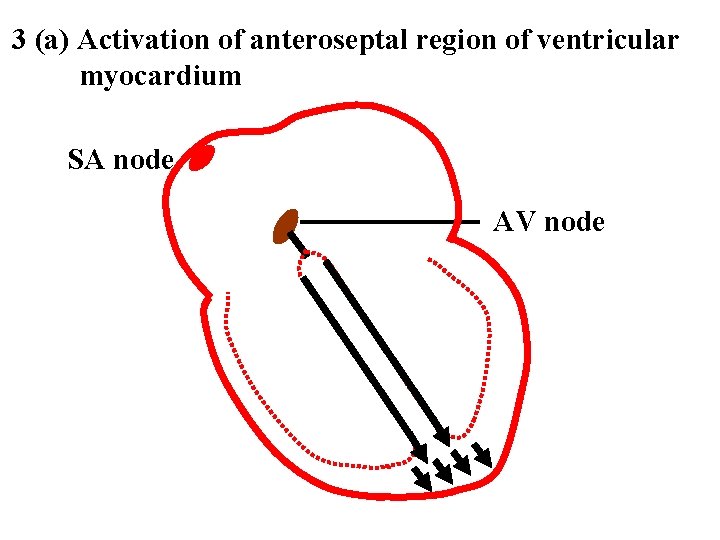 3 (a) Activation of anteroseptal region of ventricular myocardium SA node AV node 