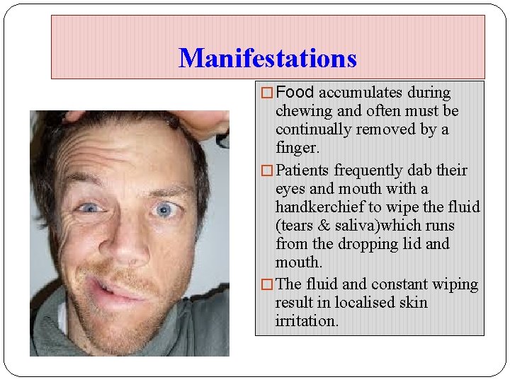 Manifestations � Food accumulates during chewing and often must be continually removed by a