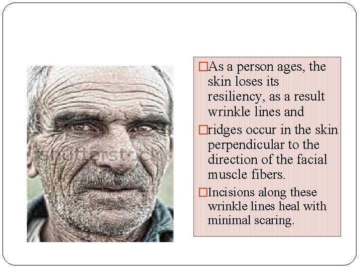 �As a person ages, the skin loses its resiliency, as a result wrinkle lines