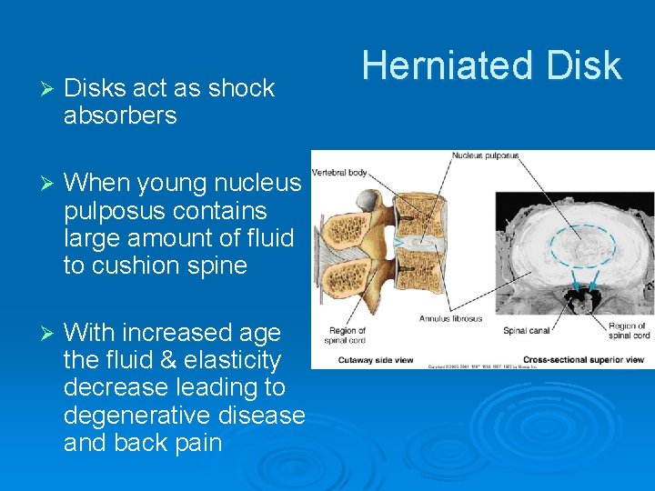 Ø Disks act as shock absorbers Ø When young nucleus pulposus contains large amount