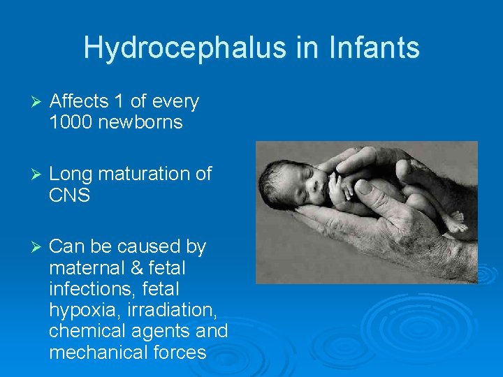 Hydrocephalus in Infants Ø Affects 1 of every 1000 newborns Ø Long maturation of