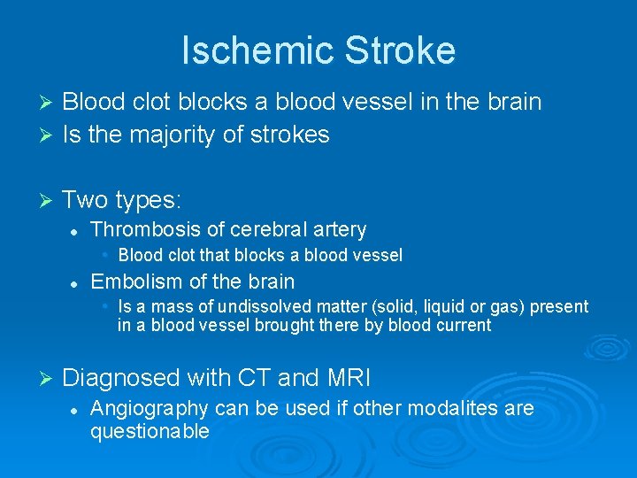 Ischemic Stroke Blood clot blocks a blood vessel in the brain Ø Is the