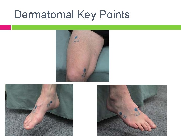Dermatomal Key Points 