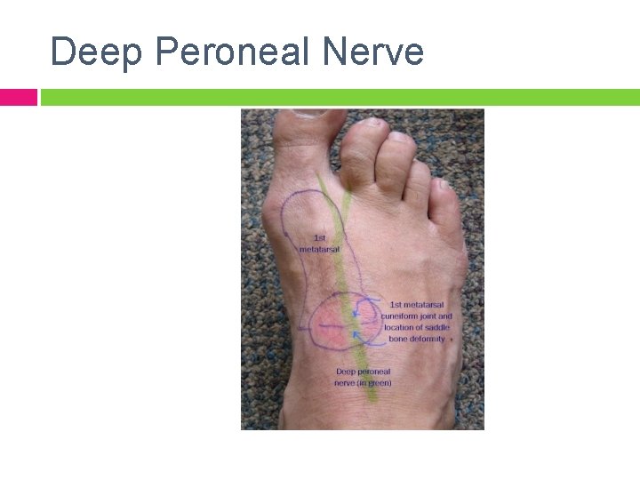 Deep Peroneal Nerve 