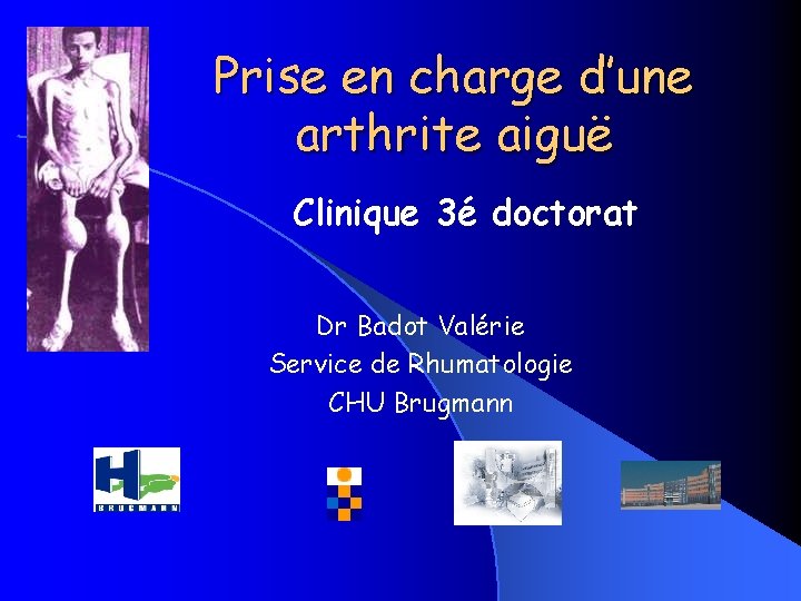 Prise en charge d’une arthrite aiguë Clinique 3é doctorat Dr Badot Valérie Service de