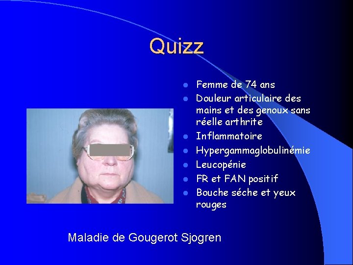 Quizz l l l l Femme de 74 ans Douleur articulaire des mains et