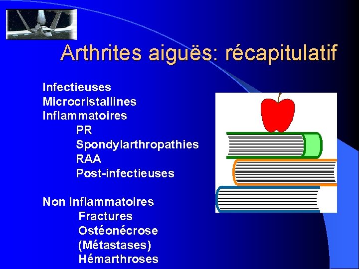 Arthrites aiguës: récapitulatif Infectieuses Microcristallines Inflammatoires PR Spondylarthropathies RAA Post-infectieuses Non inflammatoires Fractures Ostéonécrose