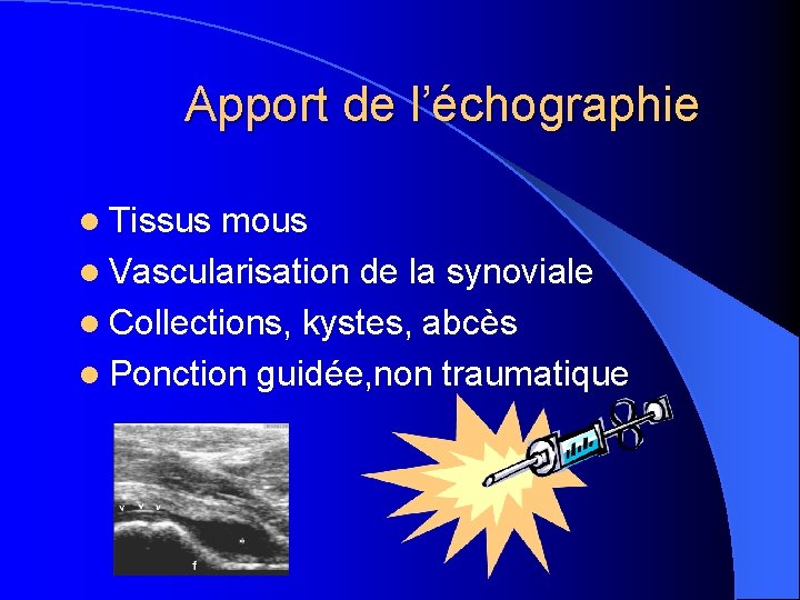 Apport de l’échographie l Tissus mous l Vascularisation de la synoviale l Collections, kystes,