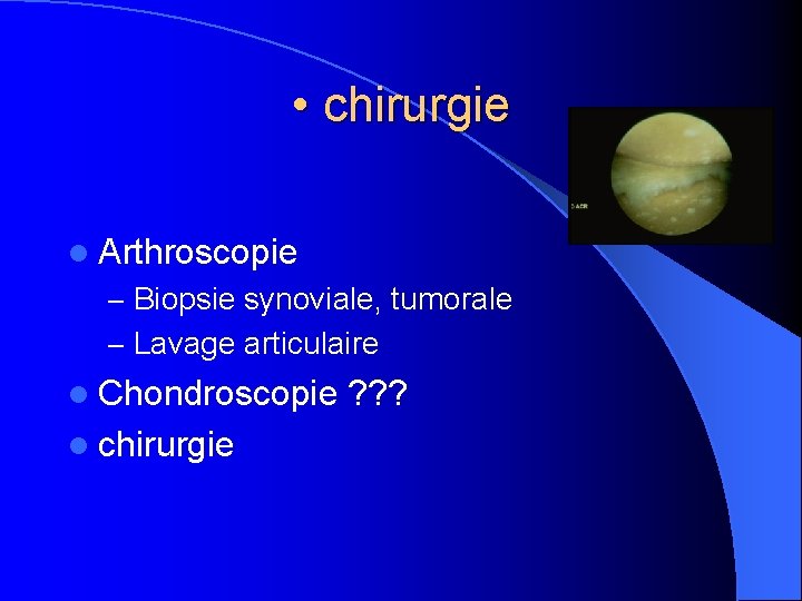  • chirurgie l Arthroscopie – Biopsie synoviale, tumorale – Lavage articulaire l Chondroscopie