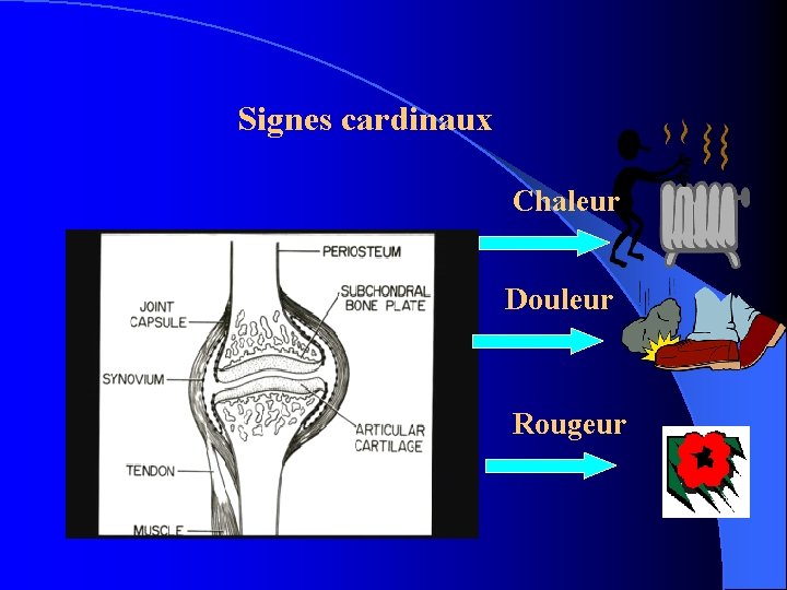 Signes cardinaux Chaleur Douleur Rougeur 