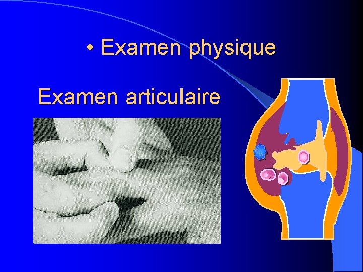  • Examen physique Examen articulaire 