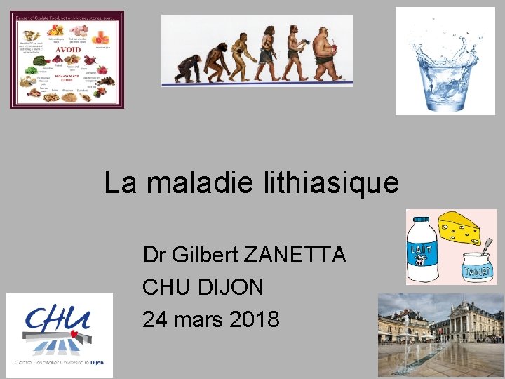 La maladie lithiasique Dr Gilbert ZANETTA CHU DIJON 24 mars 2018 