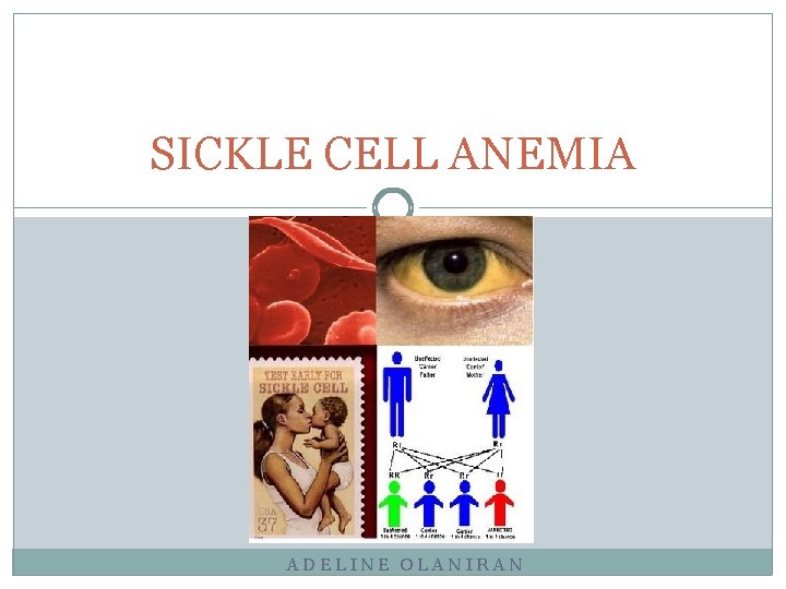 SICKLE CELL ANEMIA ADELINE OLANIRAN 