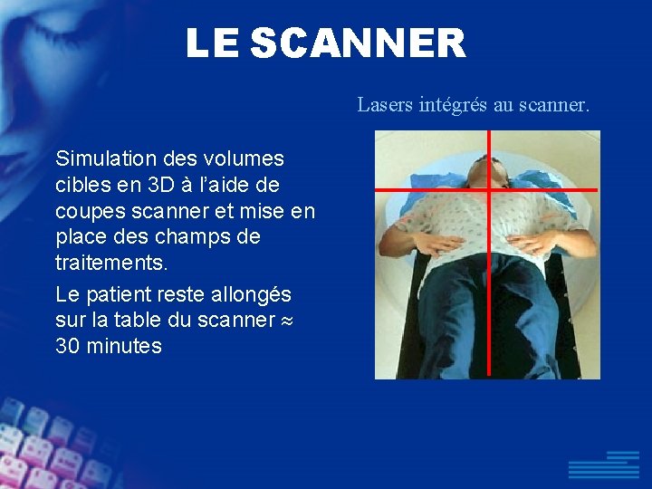 LE SCANNER Lasers intégrés au scanner. Simulation des volumes cibles en 3 D à