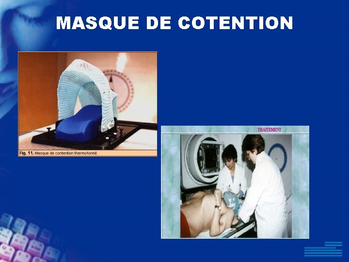 MASQUE DE COTENTION 