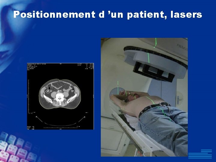 Positionnement d ’un patient, lasers 