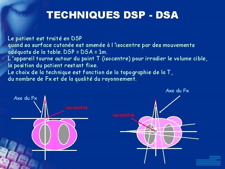 TECHNIQUES DSP - DSA Le patient est traité en DSP quand sa surface cutanée