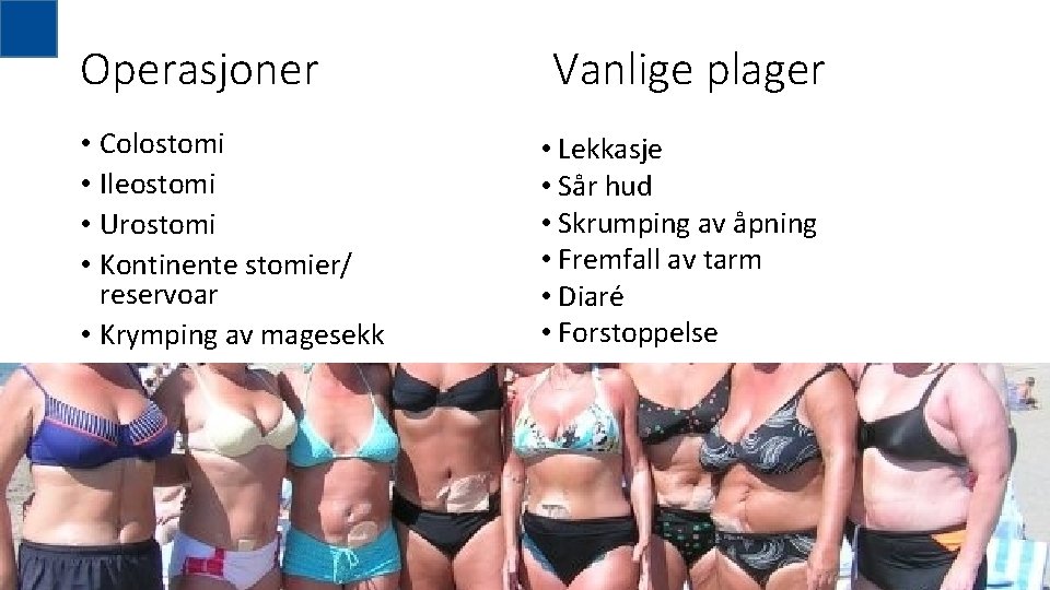 Operasjoner • Colostomi • Ileostomi • Urostomi • Kontinente stomier/ reservoar • Krymping av Operasjoner • Colostomi • Ileostomi • Urostomi • Kontinente stomier/ reservoar • Krymping av
