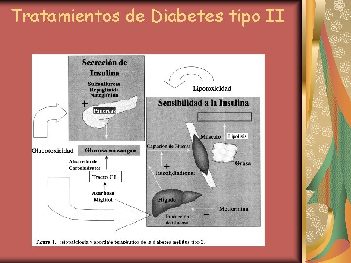 Tratamientos de Diabetes tipo II 