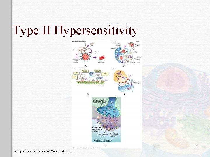 Type II Hypersensitivity 10 Mosby items and derived items © 2006 by Mosby, Inc.